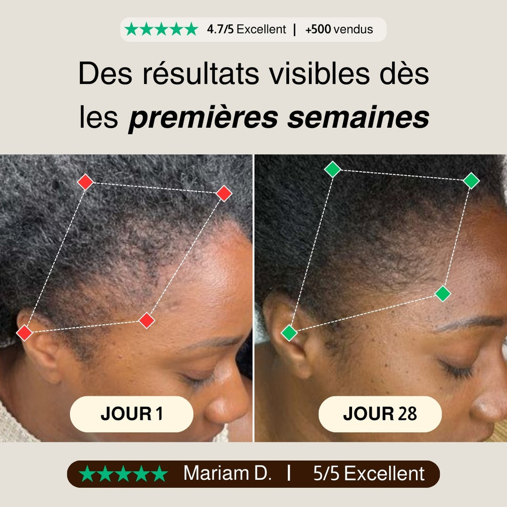 Huile de Batana – Soin Repousse Tempes